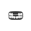 Cast Partial Denture